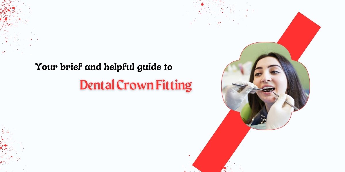 Guide To Dental Crown Fitting
